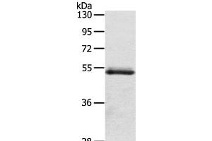 Western Blot analysis of Human normal colon sigmoideum tissue using OLFM4 Polyclonal Antibody at dilution of 1:200 (Olfactomedin 4 Antikörper)