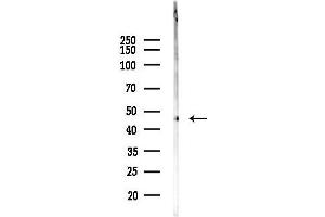 Western blot analysis of lysates from F10-LUC cells(heat-shock 45 min treatment), using SLC17 Antibody at 1/1000 dilution.