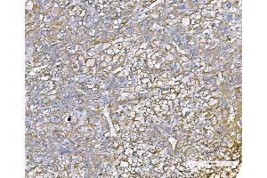 IHC analysis of Poliovirus Receptor/PVR using anti-Poliovirus Receptor/PVR antibody (ABIN7601077). (Poliovirus Receptor Antikörper  (AA 28-417))