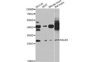 Western blot analysis of extracts of various cell lines, using KLK3 antibody (ABIN5971083) at 1/1000 dilution. (Prostate Specific Antigen Antikörper)