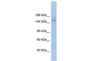 MOV10L1 antibody used at 1 ug/ml to detect target protein. (MOV10L1 Antikörper)