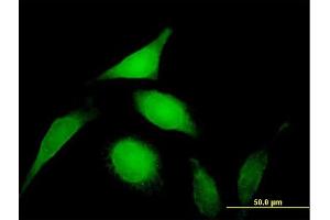Immunofluorescence of purified MaxPab antibody to PSMD14 on HeLa cell. (PSMD14 Antikörper  (AA 1-310))