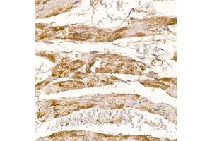 Immunohistochemistry of paraffin-embedded mouse heart using COX7 Rabbit pAb (4721) at dilution of 1:100 (40x lens). (COX7A1 Antikörper  (AA 1-79))