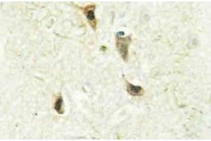 Immunohistochemistry analysis of DEC2 Antibody in paraffin-embedded human brain tissue. (BHLHE41 Antikörper)