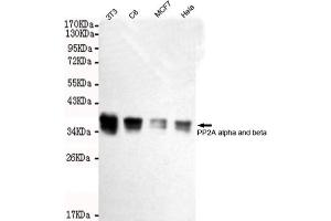 Western blot detection of A alpha and beta in Hela,MCF7,C6 and 3T3 cell lysates using A alpha and beta mouse mAb (1:2000 diluted). (PP2A alpha/beta Antikörper)