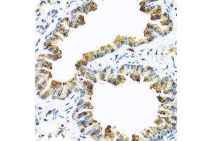 Immunohistochemistry of paraffin-embedded mouse lung using SERPINA10 antibody.