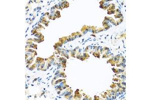Immunohistochemistry of paraffin-embedded mouse lung using SERPINA10 antibody. (SERPINA10 Antikörper  (AA 165-444))
