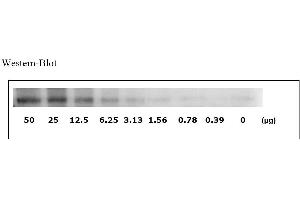 Image no. 3 for Signal Transducer and Activator of Transcription 1, 91kDa (STAT1) ELISA Kit (ABIN625230)