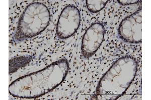 Immunostaining (ISt) image for anti-High-Mobility Group 20A (HMG20A) (AA 153-262) antibody (ABIN523758)