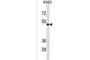 ZN Antibody (Center) (ABIN1537894 and ABIN2843344) western blot analysis in K562 cell line lysates (35 μg/lane). (ZNF733 Antikörper  (AA 156-183))