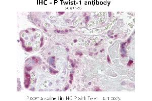 Image no. 2 for anti-Twist Homolog 1 (Drosophila) (TWIST1) (N-Term) antibody (ABIN347415) (TWIST1 Antikörper  (N-Term))
