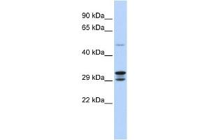 WB Suggested Anti-C14orf166 Antibody Titration:  0. (C14orf166 Antikörper  (N-Term))