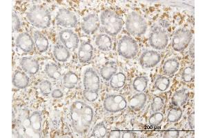 Immunoperoxidase of purified MaxPab antibody to SEPT12 on formalin-fixed paraffin-embedded human colon. (Septin 12 Antikörper  (AA 1-358))