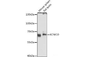 Western blot analysis of extracts of various cell lines using KCNK10 Polyclonal Antibody at dilution of 1:3000. (KCNK10 Antikörper)