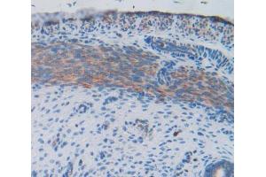 IHC-P analysis of uterus tissue, with DAB staining. (FIL1d Antikörper  (AA 1-156))