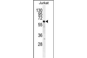 Western blot analysis in Jurkat cell line lysates (35ug/lane). (NKD2 Antikörper  (C-Term))