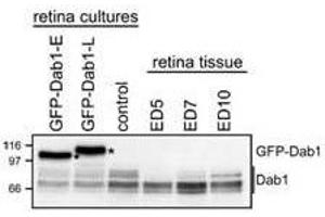 WB - Dab1 Antibody Analysis of GFP-Dab1 and endogenous Dab1 levels in transfected retinal cells and retinal tissue. (DAB1 Antikörper  (C-Term))