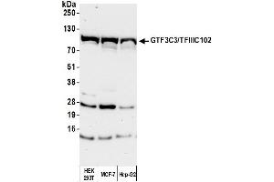 Western Blotting (WB) image for anti-General Transcription Factor 3C Polypeptide 3 (GTF3C3) (AA 475-525) antibody (ABIN7454731) (General Transcription Factor 3C Polypeptide 3 (GTF3C3) (AA 475-525) Antikörper)