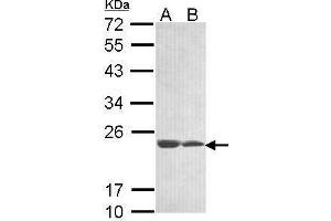 WB Image Sample (30 ug of whole cell lysate) A: 293T B: A431 , 12% SDS PAGE antibody diluted at 1:1000 (C11orf85 Antikörper  (Center))