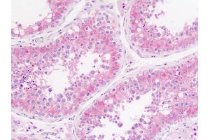 Immunohistochemistry (Paraffin-embedded Sections) (IHC (p)) image for anti-Solute Carrier Family 29 (Nucleoside Transporters), Member 1 (SLC29A1) (Ser254) antibody (ABIN6751235)
