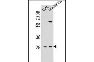 IL12B Antibody (C-term) (ABIN654420 and ABIN2844155) western blot analysis in CEM,MDA-M cell line lysates (35 μg/lane). (IL12B Antikörper  (C-Term))