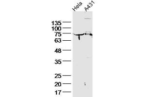 Lane 1, HeLa lysates, Lane 2, A431 lysate probed with Cytokeratin 2e Polyclonal Antibody, unconjugated  at 1:300 overnight at 4°C followed by a conjugated secondary antibody for 60 minutes at 37°C.