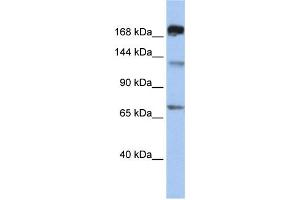 WB Suggested Anti-MTR Antibody Titration:  0. (MTR Antikörper  (C-Term))