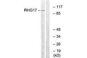 Western Blotting (WB) image for anti-rho GTPase Activating Protein 17 (ARHGAP17) (AA 331-380) antibody (ABIN2890584) (ARHGAP17 Antikörper  (AA 331-380))