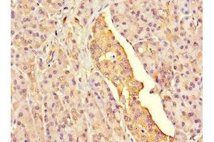 Immunohistochemistry of paraffin-embedded human pancreatic tissue using ABIN7153908 at dilution of 1:100 (G6PC2 Antikörper  (AA 78-115))