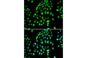 Immunofluorescence analysis of MCF-7 cells using P antibody (ABIN6132460, ABIN6145238, ABIN6145239 and ABIN6223130). (PARP3 Antikörper  (AA 301-540))