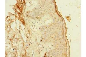 Immunohistochemistry of paraffin-embedded human skin tissue using ABIN7163413 at dilution of 1:100 (PCIF1 Antikörper  (AA 201-500))