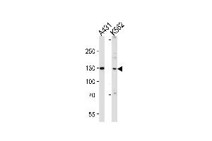 Western blot analysis of lysates from A431, K562 cell line (from left to right), using GALNT5 Antibody at 1:1000 at each lane. (GALNT5 Antikörper  (N-Term))