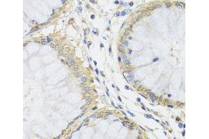 Immunohistochemistry of paraffin-embedded Human colon using MTX1 Polyclonal Antibody at dilution of 1:100 (40x lens). (Metaxin 1 Antikörper)