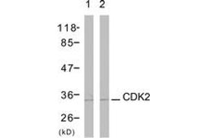 Western blot analysis of extracts from A2780 cells, using CDK2 (Ab-160) Antibody. (CDK2 Antikörper  (AA 131-180))