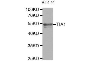 Western Blotting (WB) image for anti-TIA1 Cytotoxic Granule-Associated RNA Binding Protein (TIA1) antibody (ABIN1882364)