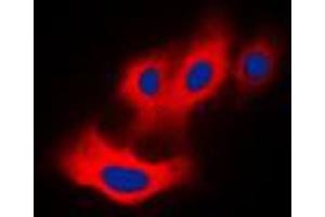 Immunofluorescent analysis of PAK4 (pS474) staining in Raw264. (PAK4 Antikörper  (C-Term, pSer474))