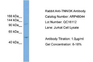 WB Suggested Anti-TNNI3K  Antibody Titration: 0. (TNNI3K Antikörper  (N-Term))