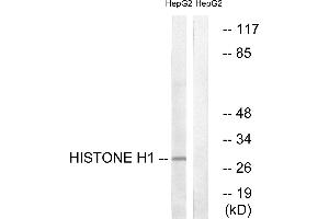 Immunohistochemistry analysis of paraffin-embedded human colon carcinoma tissue using Histone H1 (Ab-17) antibody. (Histone H1 Antikörper)