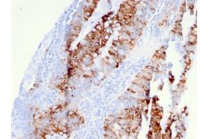 Immunohistochemistry (IHC) image for anti-Tumor Necrosis Factor Receptor Superfamily, Member 10b (TNFRSF10B) (AA 266-393) antibody (ABIN6940975)