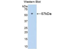 Detection of Recombinant VF, Rat using Polyclonal Antibody to Visfatin (VF) (NAMPT Antikörper  (AA 1-491))