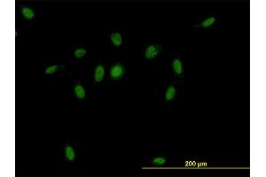 Immunofluorescence of monoclonal antibody to CSE1L on HeLa cell. (Exportin 2 Antikörper  (AA 872-971))