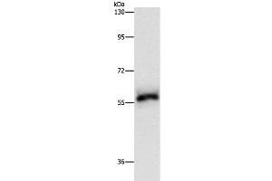Western Blot analysis of Hela cell using HCK Polyclonal Antibody at dilution of 1:500 (HCK Antikörper)