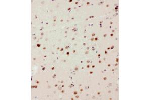 Anti-MEKK3 antibody, IHC(P): Rat Brain Tissue