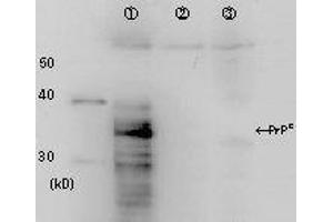 Western Blotting (WB) image for anti-Prion Protein (PRNP) antibody (ABIN2452081)