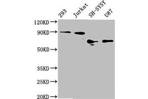 Western Blot Positive WB detected in: 293 whole cell lysate, Jurkat whole cell lysate, SH-SY5Y whole cell lysate, U87 whole cell lysate All lanes: FOXO3A antibody at 1. (Rekombinanter FOXO3 Antikörper)