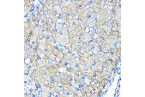 Immunohistochemistry of paraffin-embedded rat ovary using CD23 Rabbit mAb (ABIN7267160) at dilution of 1:100 (40x lens). (FCER2 Antikörper)