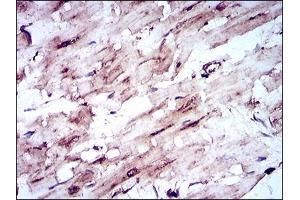 Immunohistochemical analysis of paraffin-embedded cardiac muscle tissues using SLC2A4 mouse mAb with DAB staining. (GLUT4 Antikörper  (AA 224-353))