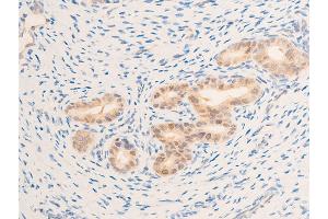 ABIN6267269 at 1/100 staining rat uterine tissue sections by IHC-P. (EGFR Antikörper  (pSer1071))