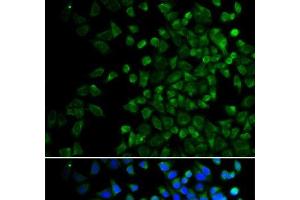 Immunofluorescence analysis of HeLa cells using BAK1 Polyclonal Antibody (BAK1 Antikörper)