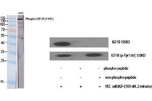 Western Blotting (WB) image for anti-Insulin-Like Growth Factor 1 Receptor (IGF1R) (pTyr1161) antibody (ABIN3182037)